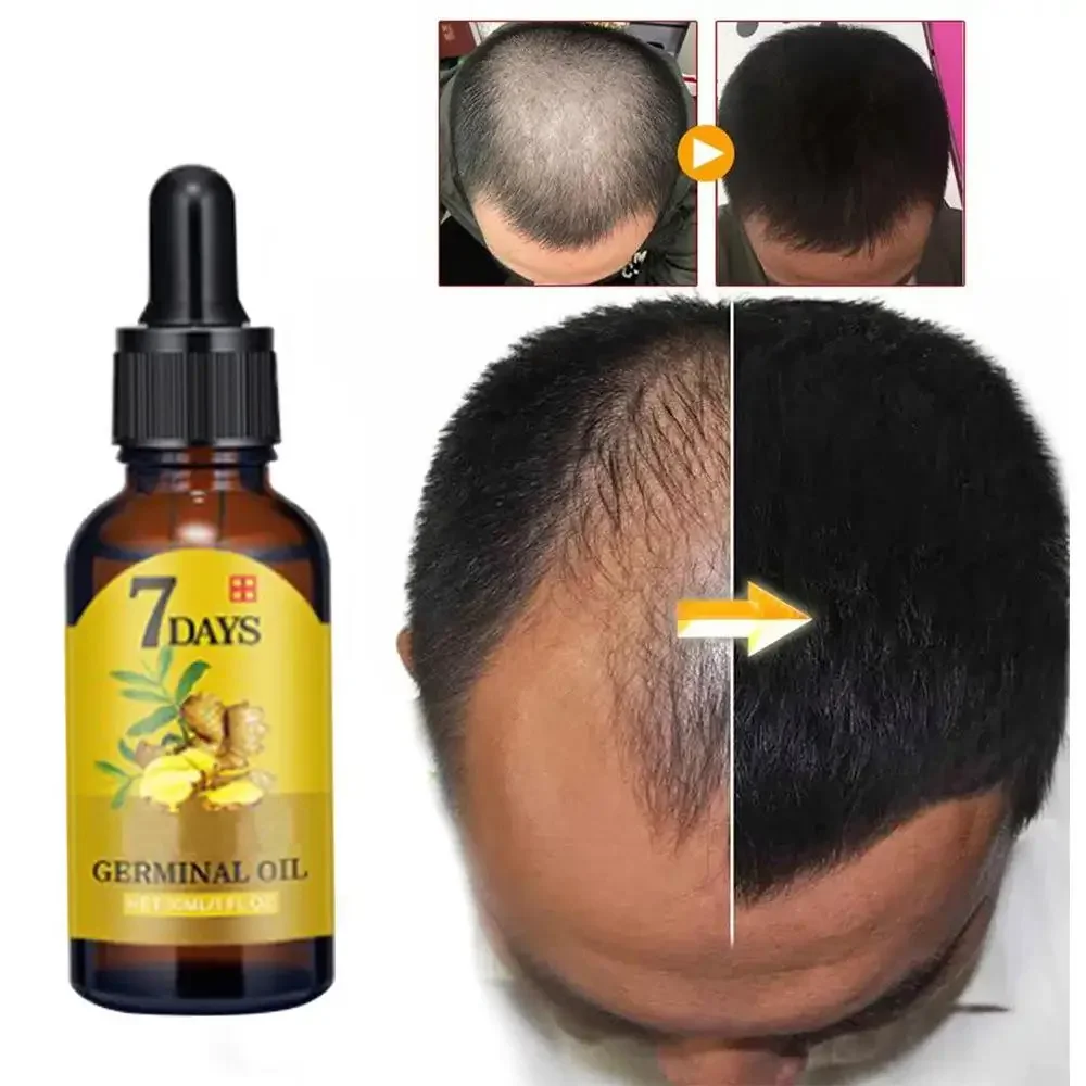 Hair Care Essence Oil Spray - Saç Büyüme Zencefil Hızlı Büyüyen Saç