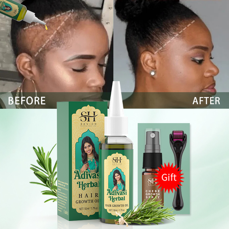 Ayurveda Saç Uzatma Yağı Hindi - Hair Care Essence Oil Spray incelemesi ve fiyatı