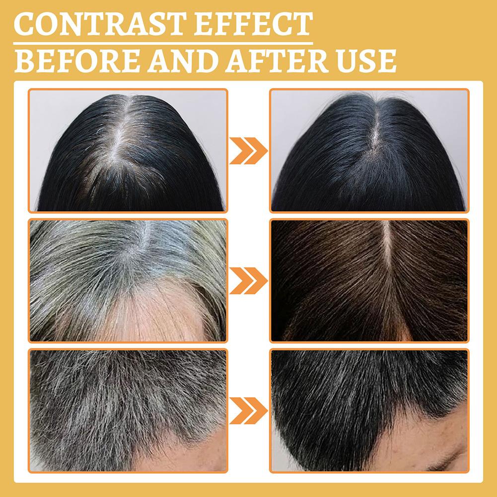 1/2PCS Saç Büyüme Serumu Yağı, - Hair Care Natural Products incelemesi ve fiyatı