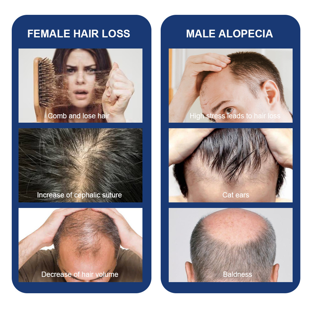 Hızlı Saç Büyüme Kremi Anti Sa - Hair Care Natural Products incelemesi ve fiyatı