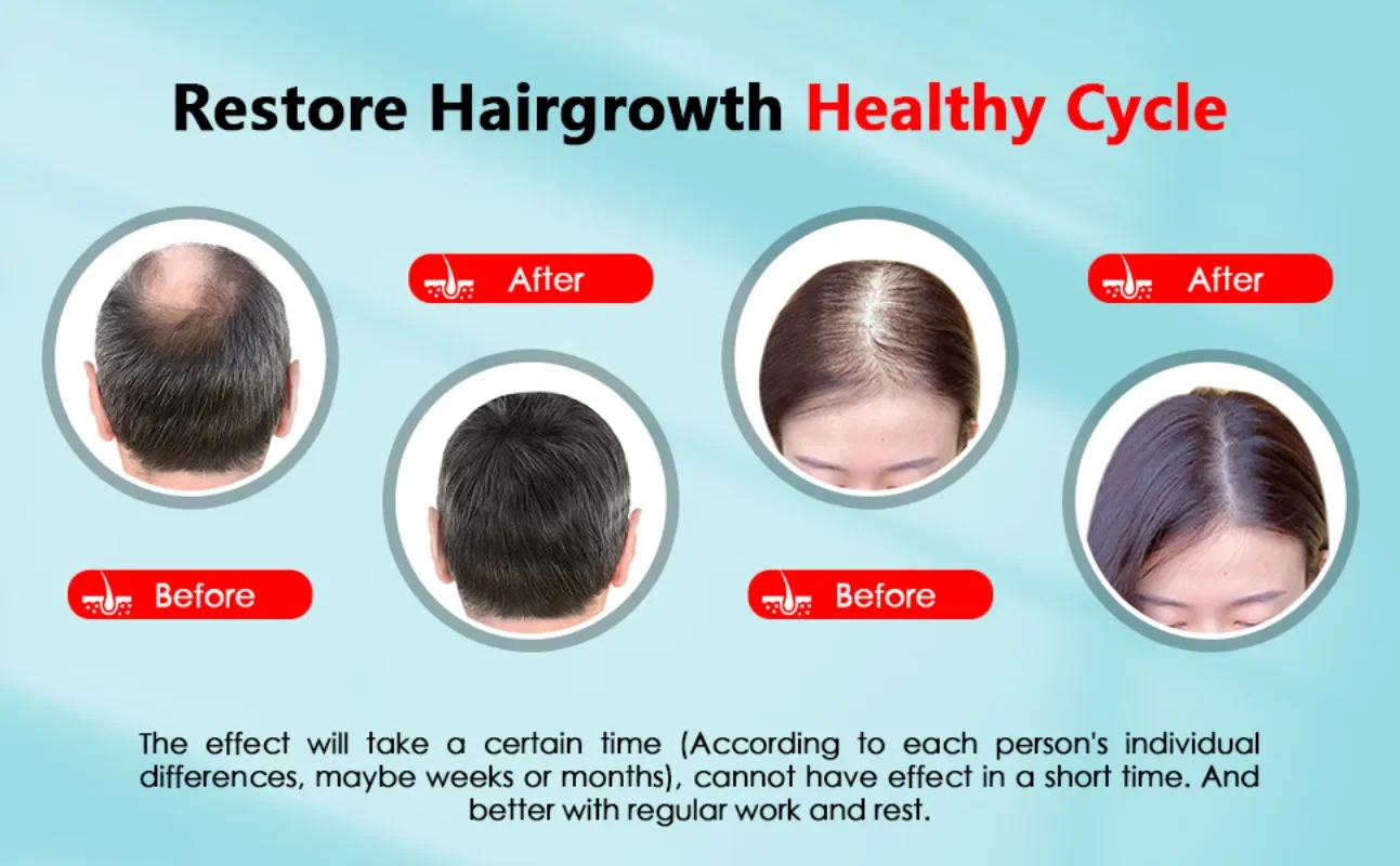 Saç Büyüme Kap Şarj Edilebilir - Hair Care Basic incelemesi ve fiyatı