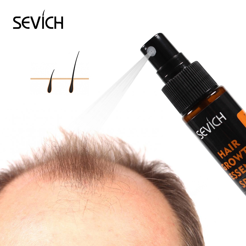 Sevich 30ml bitkisel yağı özü  - Hair Care Essence Oil Spray incelemesi ve fiyatı