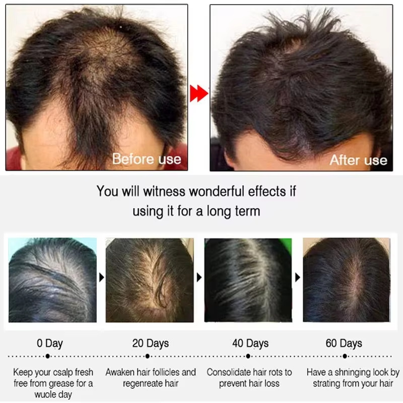 Hızlı Zencefilli Saç Uzatma Sp - Hair Care Natural Products incelemesi ve fiyatı