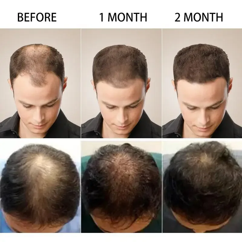 Saç Büyüme Zencefil Hızlı Büyü - Hair Care Essence Oil Spray incelemesi ve fiyatı